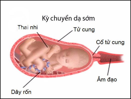 qua trinh sinh no tu nhien1 20170802 04084722 Tường tận về ba giai đoạn của quá trình sinh nở tự nhiên mẹ bầu cần biết